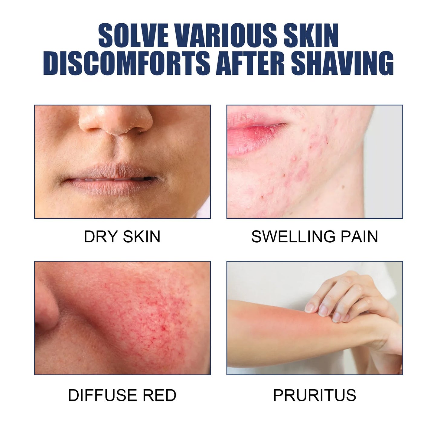 After Shave Repair Lotion - Smooth Skin & Ingrown Hair Treatment