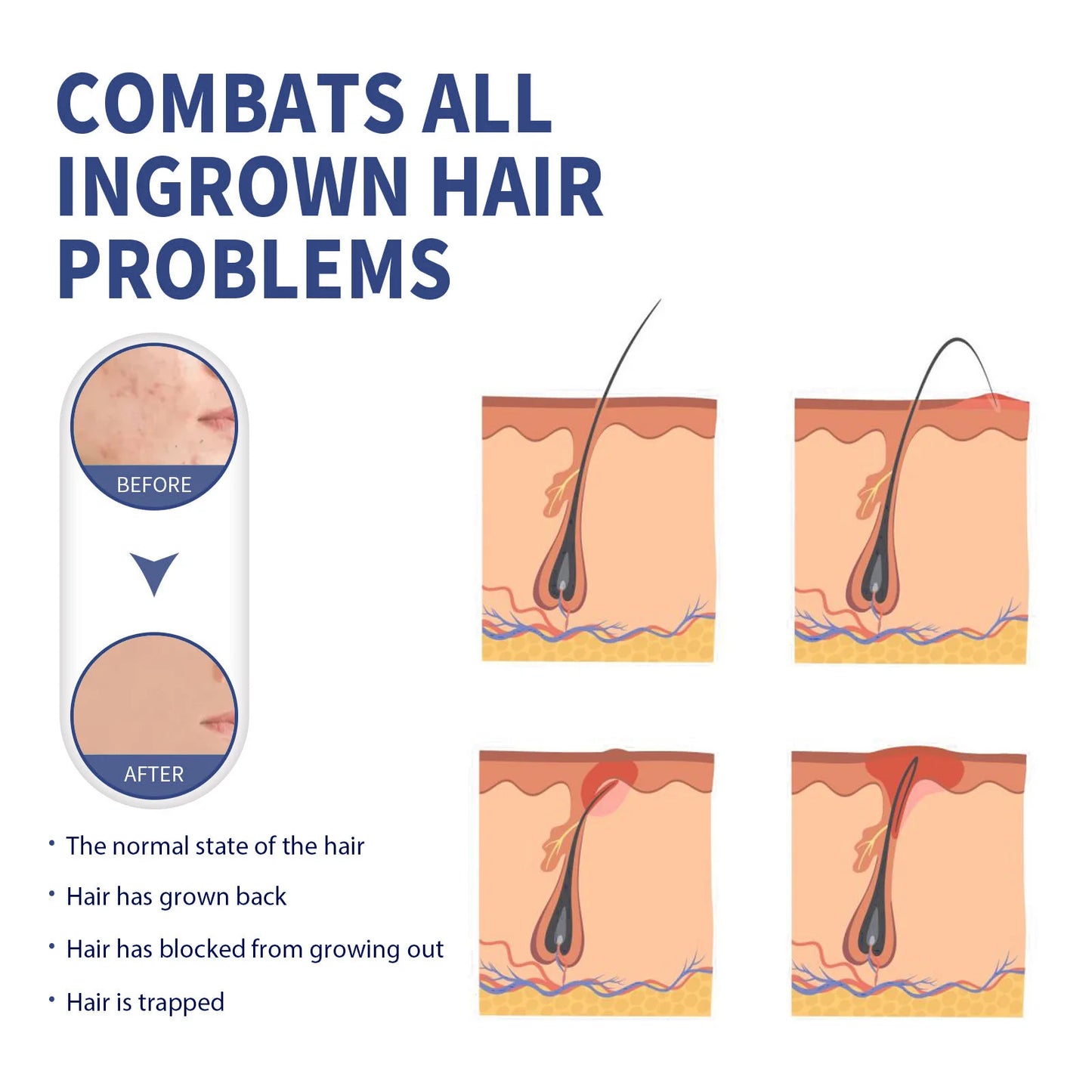 After Shave Repair Lotion - Smooth Skin & Ingrown Hair Treatment